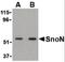 SKI Like Proto-Oncogene antibody, orb86751, Biorbyt, Western Blot image 