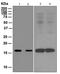 Arachidonate 5-Lipoxygenase Activating Protein antibody, TA310491, Origene, Western Blot image 