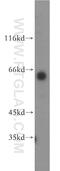 Phosphatidylinositol-4-phosphate 5-kinase type-1 beta antibody, 12541-1-AP, Proteintech Group, Western Blot image 