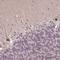 Zinc Finger Protein 709 antibody, HPA053153, Atlas Antibodies, Immunohistochemistry paraffin image 
