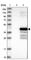 Coiled-Coil Domain Containing 24 antibody, HPA035424, Atlas Antibodies, Western Blot image 