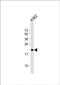 FEV Transcription Factor, ETS Family Member antibody, PA5-72274, Invitrogen Antibodies, Western Blot image 