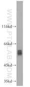 Peroxisome proliferator-activated receptor alpha antibody, 15540-1-AP, Proteintech Group, Western Blot image 