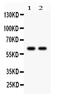 Cytochrome P450 Family 1 Subfamily B Member 1 antibody, PB9546, Boster Biological Technology, Western Blot image 