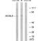 Long-chain-fatty-acid--CoA ligase 6 antibody, A07813, Boster Biological Technology, Western Blot image 