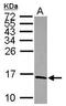 NADH:Ubiquinone Oxidoreductase Subunit S5 antibody, GTX101829, GeneTex, Western Blot image 