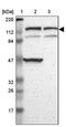 Diaphanous Related Formin 2 antibody, PA5-52173, Invitrogen Antibodies, Western Blot image 