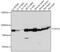 Follistatin Like 4 antibody, 18-325, ProSci, Western Blot image 