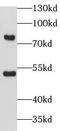 Calcium Binding Tyrosine Phosphorylation Regulated antibody, FNab01170, FineTest, Western Blot image 