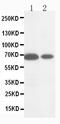 Matrix Metallopeptidase 16 antibody, PA5-79681, Invitrogen Antibodies, Western Blot image 