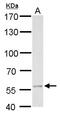 Malonyl-CoA decarboxylase, mitochondrial antibody, PA5-22081, Invitrogen Antibodies, Western Blot image 