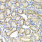 ST3 Beta-Galactoside Alpha-2,3-Sialyltransferase 4 antibody, LS-C335650, Lifespan Biosciences, Immunohistochemistry paraffin image 