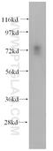Sodium Channel And Clathrin Linker 1 antibody, 14875-1-AP, Proteintech Group, Western Blot image 