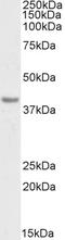 Keratin 10 antibody, orb376620, Biorbyt, Western Blot image 