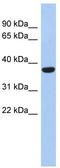 Phospholipid Phosphatase 6 antibody, TA333316, Origene, Western Blot image 