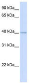 Mitochondrial Ribosomal Protein L39 antibody, TA339339, Origene, Western Blot image 