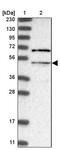 Malonyl-CoA decarboxylase, mitochondrial antibody, PA5-56803, Invitrogen Antibodies, Western Blot image 