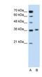 Pipecolic Acid And Sarcosine Oxidase antibody, NBP1-60060, Novus Biologicals, Western Blot image 