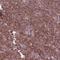 Cell Division Cycle 42 antibody, HPA069590, Atlas Antibodies, Immunohistochemistry paraffin image 