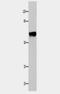 Cyclic nucleotide-gated olfactory channel antibody, TA321685, Origene, Western Blot image 