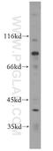 Echinoderm microtubule-associated protein-like 1 antibody, 12765-1-AP, Proteintech Group, Western Blot image 