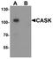 CASK antibody, LS-B8838, Lifespan Biosciences, Western Blot image 
