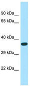 Ankyrin Repeat And SOCS Box Containing 14 antibody, TA331671, Origene, Western Blot image 