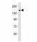 Tet Methylcytosine Dioxygenase 1 antibody, F53223-0.4ML, NSJ Bioreagents, Western Blot image 