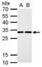 Deoxycytidine kinase antibody, PA5-27787, Invitrogen Antibodies, Western Blot image 