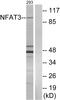 Nuclear Factor Of Activated T Cells 4 antibody, LS-C117673, Lifespan Biosciences, Western Blot image 