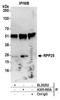 Ribonuclease P And MRP Subunit P25 antibody, A305-093A, Bethyl Labs, Immunoprecipitation image 