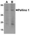 Pellino E3 Ubiquitin Protein Ligase 1 antibody, TA326634, Origene, Western Blot image 