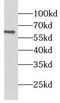 Leucine Rich Repeat LGI Family Member 2 antibody, FNab04761, FineTest, Western Blot image 