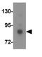 Dual Specificity Tyrosine Phosphorylation Regulated Kinase 1A antibody, GTX31433, GeneTex, Western Blot image 