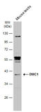 DNA Meiotic Recombinase 1 antibody, GTX103062, GeneTex, Western Blot image 