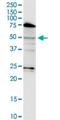 Ceramide Synthase 3 antibody, H00204219-M02-100ug, Novus Biologicals, Western Blot image 
