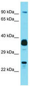 Josephin Domain Containing 1 antibody, TA337366, Origene, Western Blot image 