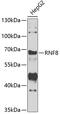 E3 ubiquitin-protein ligase RNF8 antibody, GTX55783, GeneTex, Western Blot image 