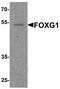 Forkhead Box G1 antibody, A01852, Boster Biological Technology, Western Blot image 