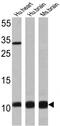 S100 Calcium Binding Protein A1 antibody, MA5-12969, Invitrogen Antibodies, Western Blot image 