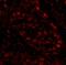 Poly(ADP-Ribose) Polymerase 1 antibody, IHC-00279, Bethyl Labs, Immunohistochemistry paraffin image 