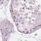 Liver carboxylesterase 1 antibody, NBP1-85691, Novus Biologicals, Immunohistochemistry paraffin image 