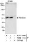 Abraxas 1, BRCA1 A Complex Subunit antibody, A302-181A, Bethyl Labs, Immunoprecipitation image 