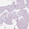 Aquaporin 3 (Gill Blood Group) antibody, HPA014924, Atlas Antibodies, Immunohistochemistry frozen image 
