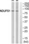 NADH-ubiquinone oxidoreductase 75 kDa subunit, mitochondrial antibody, abx014636, Abbexa, Western Blot image 