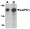 CAPS1 antibody, LS-B4591, Lifespan Biosciences, Western Blot image 