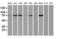 Catenin Beta 1 antibody, LS-C114344, Lifespan Biosciences, Western Blot image 
