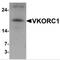 VKOR1 antibody, MBS150932, MyBioSource, Western Blot image 