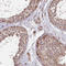 DmX-like protein 2 antibody, HPA039375, Atlas Antibodies, Immunohistochemistry paraffin image 