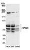 Spartin antibody, A305-375A, Bethyl Labs, Western Blot image 